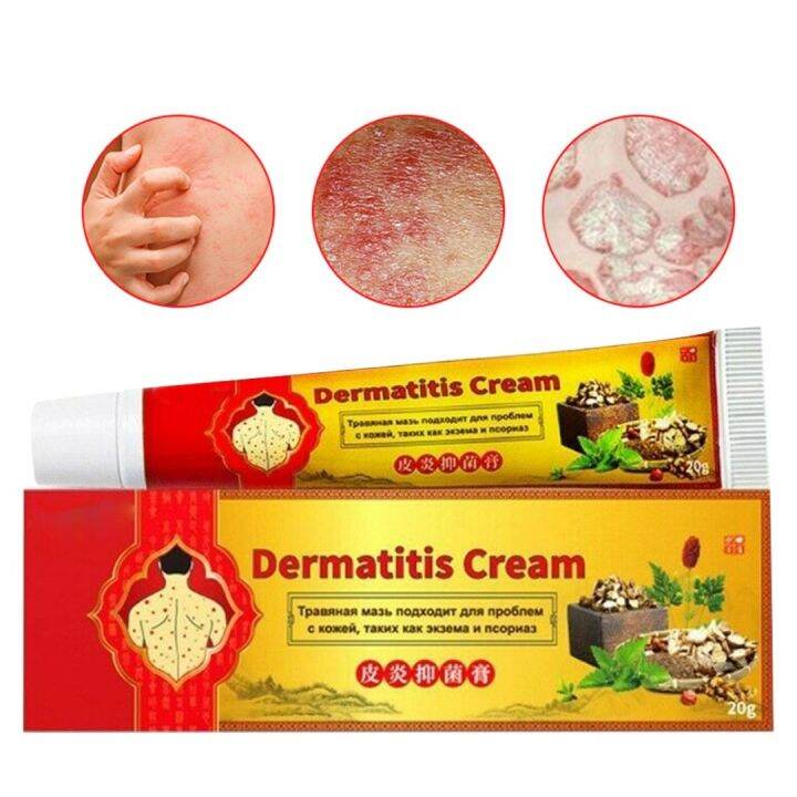 1 Pc 20g Effective Psoriasis Eczema Tinea Rash Cream Anti-itching 