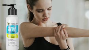 Arnica Cream Bruise Relief Lotion for Bruising and Swelling On Skin    Bruise Cream Extra Strength Vitamin K Cream    Moisturizing Arnica Bruise Formula Skin Care Gel W/Collagen 4 Fl Oz