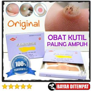 Koyo/Plester Obat Kutil Mata Ikan Dan Kapalan Ji Yan Gao