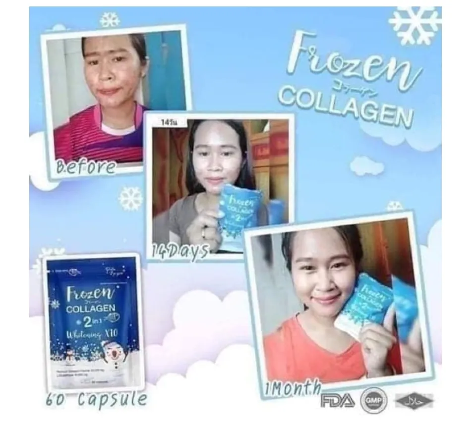 Original Frozen Collagen Glutathione 2in1 Whitening 10X Authentic Thailand  glutathione capsule, Gluta Frozen with QR code Skin Whitening, Frozen not  ishin, relumins | Lazada PH