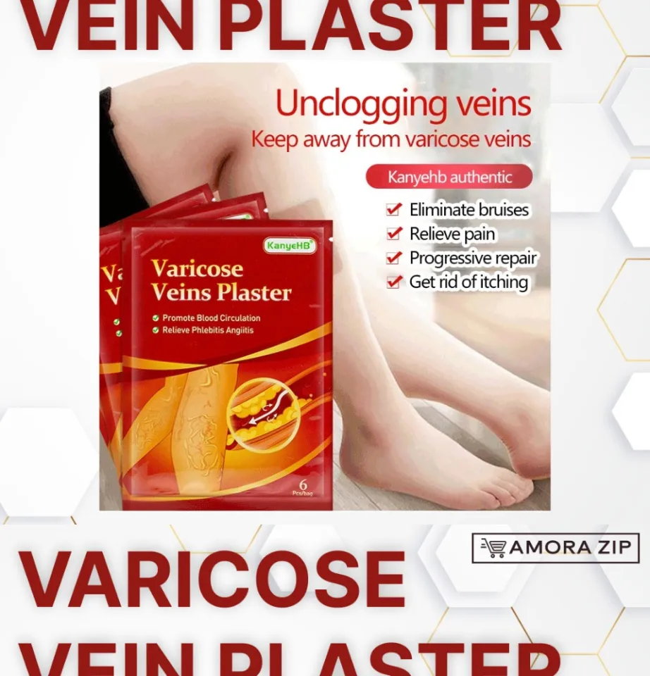 Varicose veins remover effective original Varicose veigns remove for legs  original varicose veigns compression stockings varicose