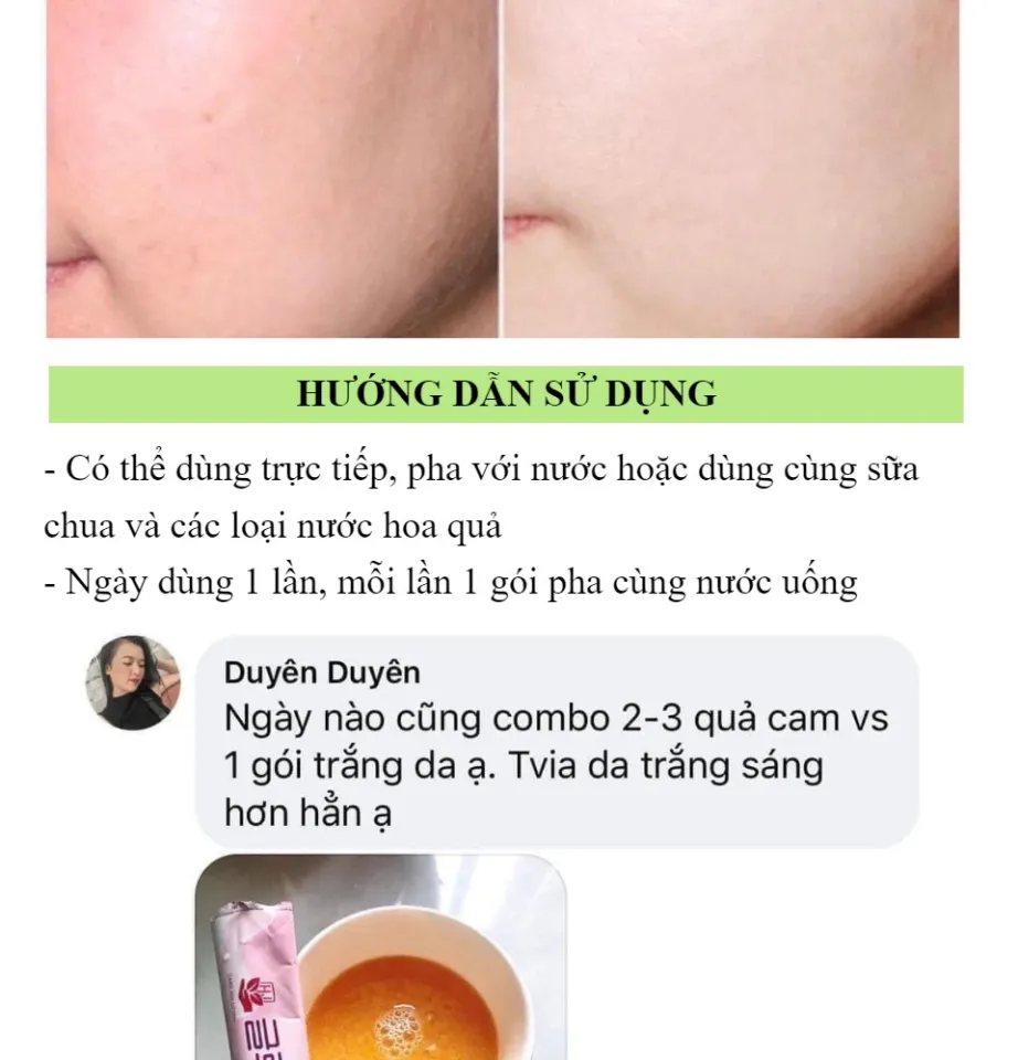 cch ung bt trng da glutathione c hn quc Ngm Gilaa Glow White Review tt tn tt v
