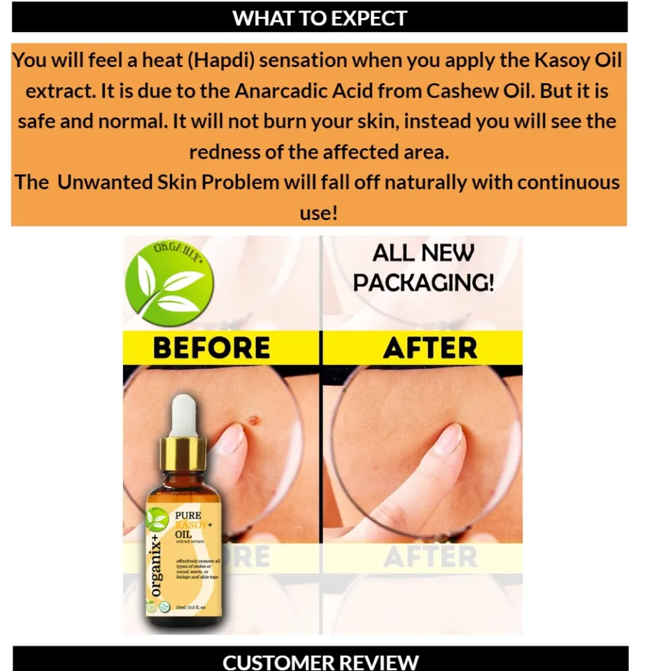 Eshakdagi keksa ayolning surati Yalangoch Lili Koul