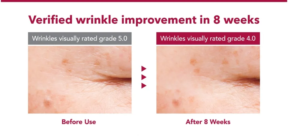 New Launch] One By Kose The Wrinkless W 18g - Anti-wrinkle