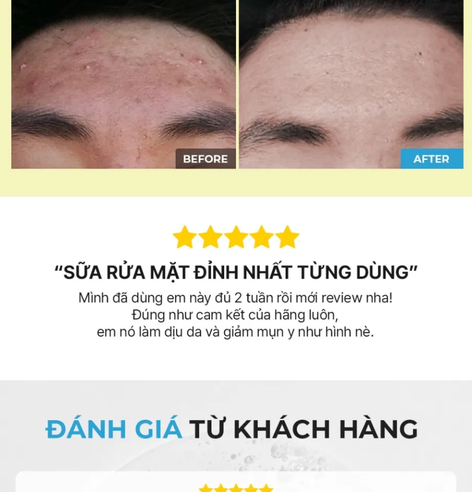 Sữa Rửa Mặt Cosrx Low pH Melen Good Morning Gel Cleanser 150ml | Lazada  Việt Nam