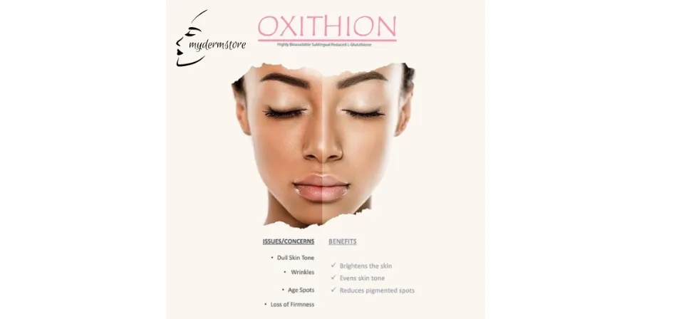 sublingual glutathione for skin whitening Glutathione as a skin‐lightening agent and in melasma: a systematic review  - Sarkar - 2025 - International Journal of Dermatology main image 0