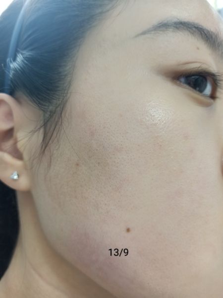 Buyer review image 4
