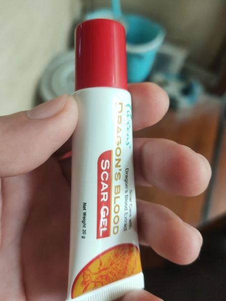 Buyer review image 1
