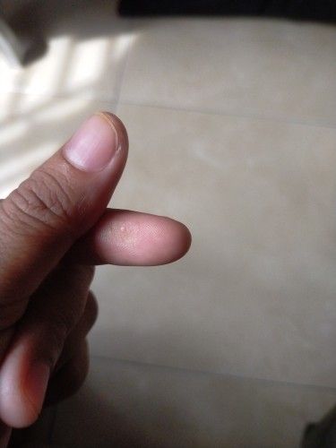 Buyer review image 2
