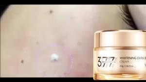 Freckle cream Whitening dark spot remover cream Serum for dark spot 377 Melasma cream 30g/box Freckle removal brightening Inhibit melanin deposition