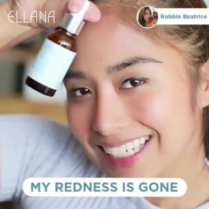 ELLANA Serum Duo: Clear Clarifying Skin Serum + Even Skin Pore Minimizing Dark Spot Skin Serum & Gift Box