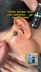 Paket Gorsir 5 PCS Swiss Paris Lotion Menghilangkan Tahi Lalat di wajah
