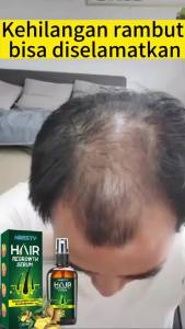 Hair growth serum spray Anti tonik rambut rontok Pertumbuhan rambut cepat 30ml Serum Pemanjang & Penumbuh Rambut tercepat No1 Di Indonesia