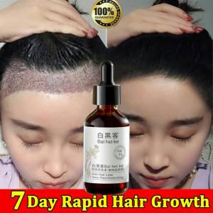 Serum Penumbuh Rambut Botak & Cegah Rontok