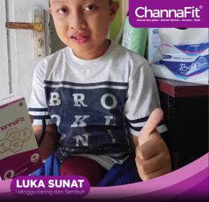 Sirup Penyembuh Luka ChannaFit Ekstrak Ikan Gabus Albumin Booster Channa Fit Pasca Operasi Suplemen Imun Tubuh