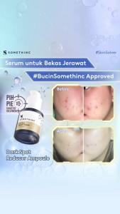 Somethinc Dark Spot Reducer Ampoule 20ml 114775611