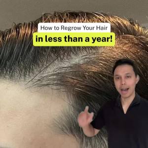 andSons Intense Hair Growth Gift Set for Men | Shampoo + Conditioner + 3% Redensyl Serum + Dermaroller