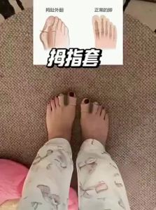 GUOQI | Bunion Corrector Toe Separator