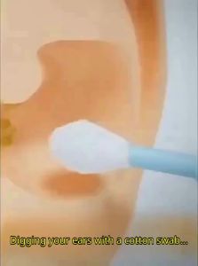 IMLUCKY | Safe Adhesive Ear Cleaner Childrens Ear Pick