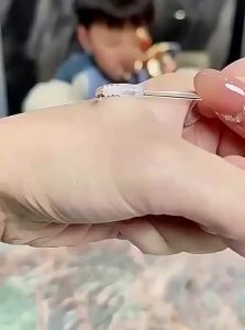 Ear Wax Removal Stick Ear Pick