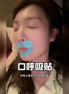 OhOcean | Anti Mouth Breathing Device