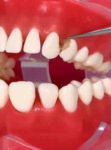CMGF | Stainless Steel Toothpick for Portable Use with Dental Picking and Cleaning Functions