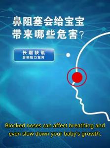 babyfutur | Nasal Aspirator Nasal Mucus Removal Device
