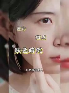 RUYI | Whitening Spot-Reducing Moisturizing Cream