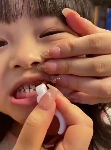 Tooth Stain & Plaque Removal Childrens Teeth Cleaner